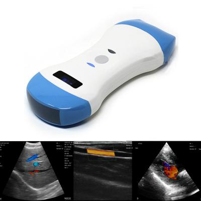 China Abdomen 5G Wifi 3 in 1Cardiac Ultrasound Scanner Wireless Dual Head Ultrasound Probe for sale