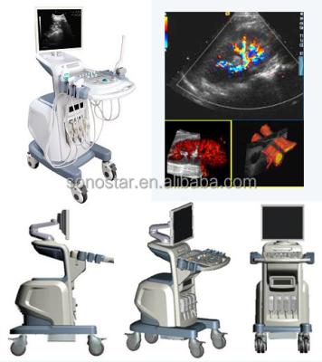 China Hospital Clinic Veterinary Color Ultrasound Doppler Machine With Trolley SS-2000 Sonostar Manufacturer for sale