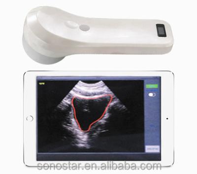 China Plastic Wireless Mini Ultrasound Probe (4D Bladder Scanner) for sale