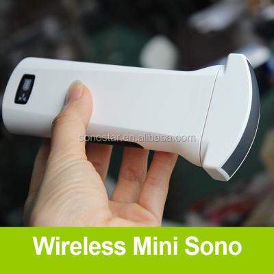 China Mini Sono Handheld Wireless Portable Color Doppler Abdomen Ultrasound Diagnostic Devices for sale