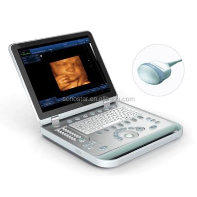 China SS-10Plus Portable Pregnancy 4D Ultrasound Machine Price for sale