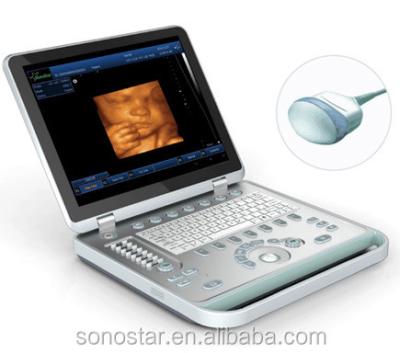 China Hot Selling Portable Pregnancy 4D Ultrasound Machine Price Bady Monitor SS-10More for sale