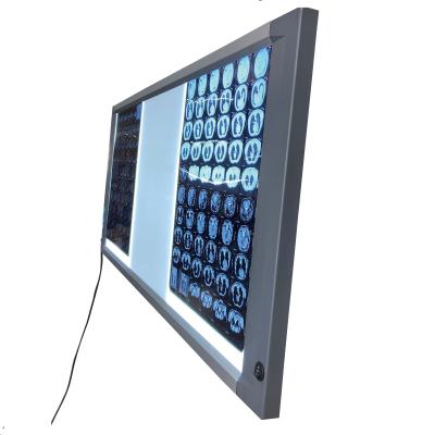 China Hospital Equipment LED Digital Mst-4000III Triple Panels X-Ray Source Film Negatoscope Viewer 1223X502X25mm 1223X502X25mm for sale