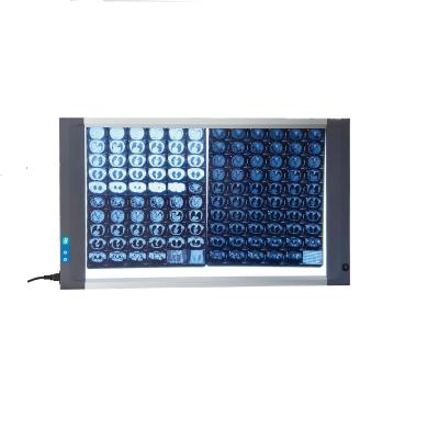 China Dual Panel Medical X Ray LED Film Viewer Negatoscope Viewbox 857X502X25mm 857X502X25mm for sale