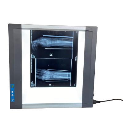 China Super Slim LED X Ray Film Viewer With Digital Negatoscope 502X502X25mm Control 502X502X25mm for sale