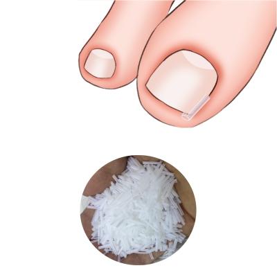 China Durable toe straightener corrector source flexible toe splint feet bunion corrector toe nail corrector patch for sale