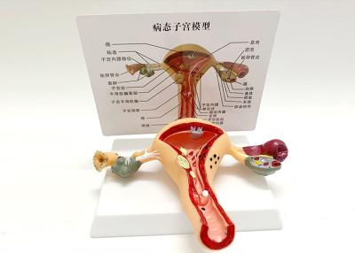 China Pathological Female Anatomical Model / Vagina Uterus Ovary Model Genitourinary for sale