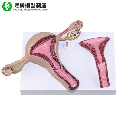 China Women Internal Female Reproductive Anatomy Model Uterine Gynecological for sale