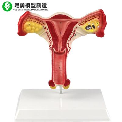 China Human Uterus  Ovary Female Anatomical Model Vaginal Students Learning for sale