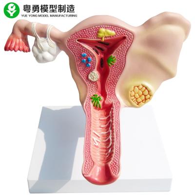 China Female Reproductive System Anatomy Model Genitourinary Medical Teaching for sale