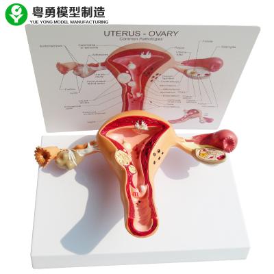 China Medical Teaching Female Anatomical Model Pathological Uterine Vagina Genitourinary for sale