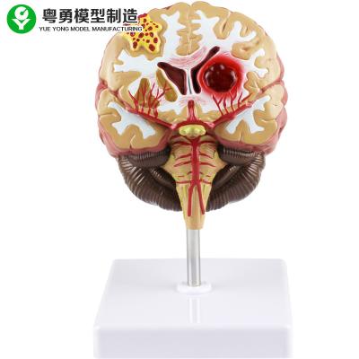 China Pathologies Medical Brain Anatomy Model / Brain Human Anatomical Model for sale