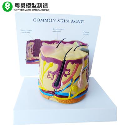 China Blackhead Acne Hair Follicle Model Skin Anatomy 16X12X12 Cm Single Package Size  for sale