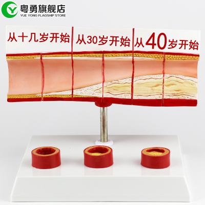 China Heart Vascular Cholesterol Model Human Heart Medical Teaching Anatomical for sale