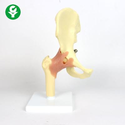 China Plastic Anatomy Hip Joint Model For Teaching 0.6 Kg Single Gross Weight for sale