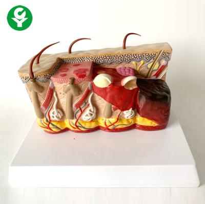 China Educational Burn Skin Hair Anatomy Model For Medical School Students Teaching for sale