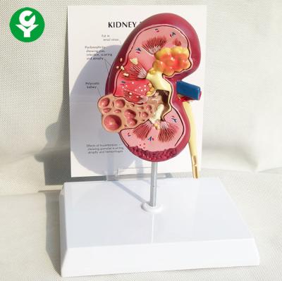 China Pathology Human Renal Anatomy Model Health 18X14X12 Cm Single Package for sale