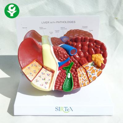 China Hepatic Liver Pathological Liver Anatomy 3d Model Easy Preserve Durable for sale