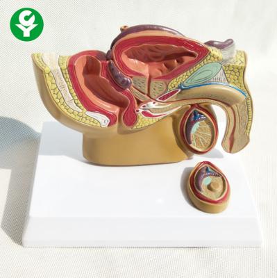 China Male Reproductive System Anatomy Model Diseased Reproductive Prostate Visceral for sale