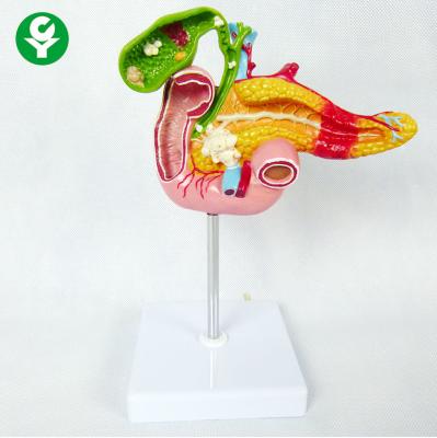 China Visceral Pathology Model Teaching Biliary Splenic Pancreatic Demonstration for sale