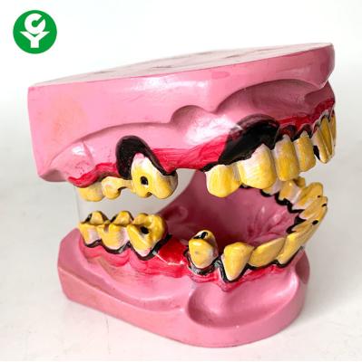 China Smoking Tobacco Dental Teeth Model / Smokers ' Teeth Oral Model Pvc Material for sale