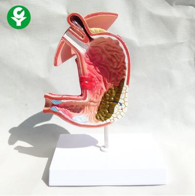 China Stomach-Gastric Diseases Human Body Organs Model / Human Digestive System Model for sale