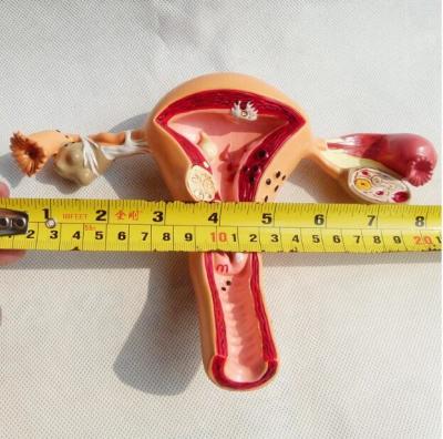 China Female Anatomical Model Pathological Uterine Vagina Genitourinary for sale