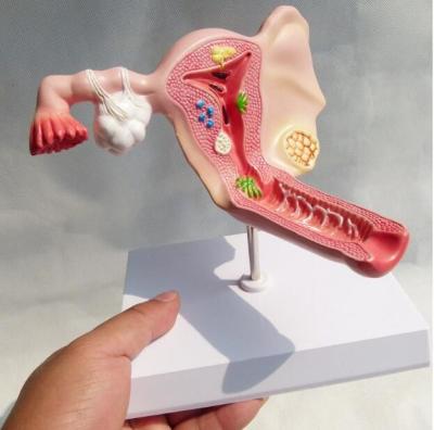 China Female Reproductive System Anatomy Model Genitourinary Teach for sale