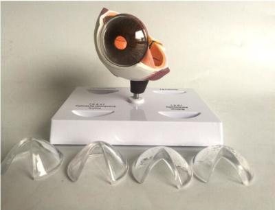 China Human Eye Anatomy Model Corneal Disease Conditions Demonstrated for sale