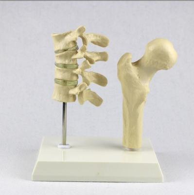 China Vertebra Thighbone Osteoporosis Model Life Size Human Lumbar Carton Packing for sale