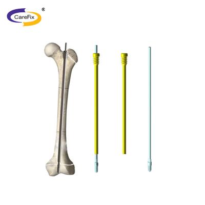 China Titanium Alloy Tibia Tibia Nail Set Orthopedic Intramedullary Proximal Femur Locking Nail Set for sale