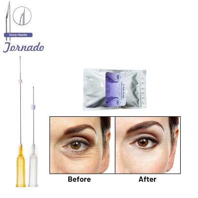 China Adult hot sale on line ultra v line face lift tornado 27G 38mm twist pdo actions wire lifting for fine lines use for sale