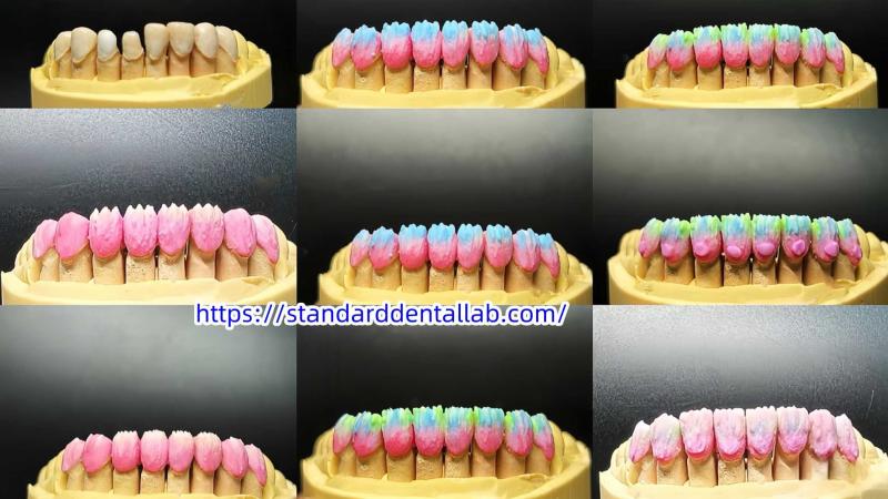 確認済みの中国サプライヤー - Standard Dental Lab Co., Limited