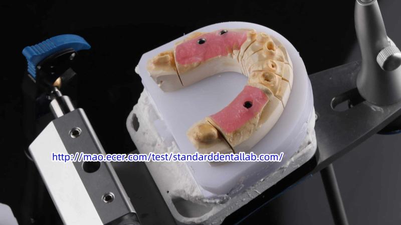 Verifizierter China-Lieferant - Standard Dental Lab Co., Limited