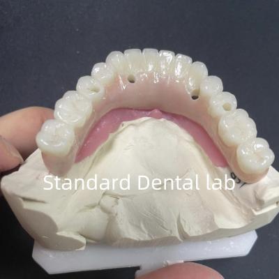 China Restauración estética Todos en 4 implantes dentales Circonia Hipoalergénico en venta