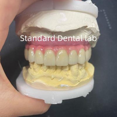 China Puente Malo Hibrido Zirconia Todo en Cuatro / Seis Zirconia Puente Implante Titanio Barra en venta