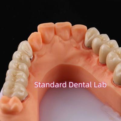 China Digital Non Precious Metal Porcelain Crown PFM Bridge Dental for sale