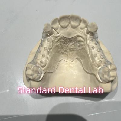 China Removable Cast Clear Framework Partial Easy To Clean And Take Off for sale