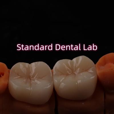 China Laboratorio Dental de Bruxier de contorno completo de zircónia monolítica de Crown Bridge en venta