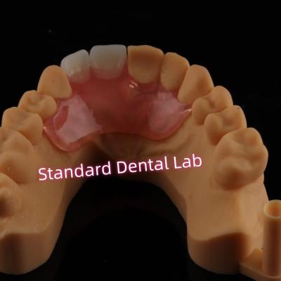 China Dental Valplast Flexible Flipper Prothesen Ausnehmbare Teilprothese zu verkaufen