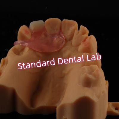 China Upper Valplast Unilateral Dentures Removable Flexible One Tooth Partial Teeth for sale