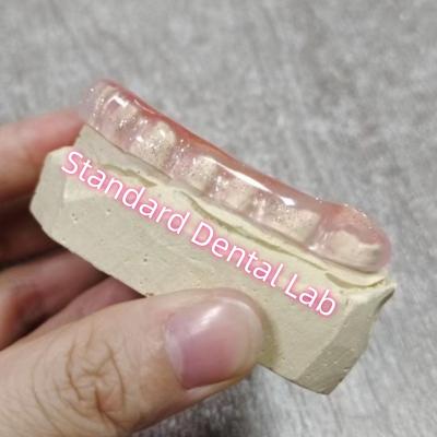 China Bruxismo Dental Oclusal Flanca de la Guardia Nocturna Laboratorio Dental Estándar en venta