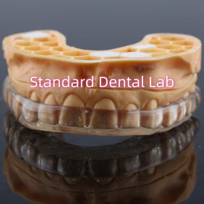 China Protector dental profesional personalizado contra el ronquido Protector bucal nocturno mejorado para rechinar dientes en venta