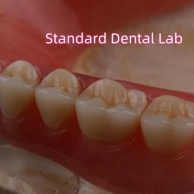 China SDL Heat Cured Acrylic Partial Denture Ivoclar Teeth Dental Lab High Accuracy for sale