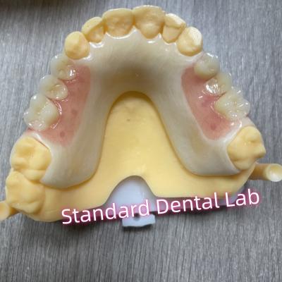 China Quadro Acetálico Clap Acrílico Dentes Parciais Removíveis à venda