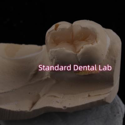 Cina Intaglio dentale in porcellana fusa Intaglio di zirconia Emax Alta estetica in vendita