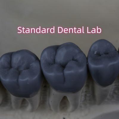 Cina Professionale Digital Dental Lab Wax Up 3shape approvato dalla FDA in vendita