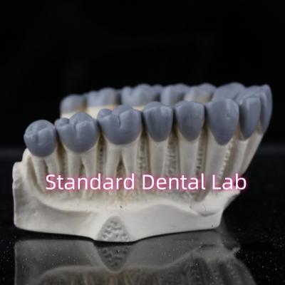 Cina SDL Dental Lab Digital Diagnostic Wax Ups Crown Bridge in vendita