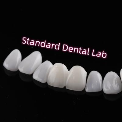 China Abrasion Resistant Emax Zirconia Laminate Veneers Incisal Translucency for sale