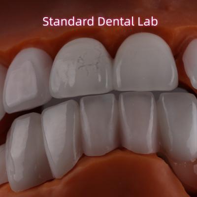 China Ivoclar Emax Zirconia Veneers laminadas translúcidas OEM ODM en venta